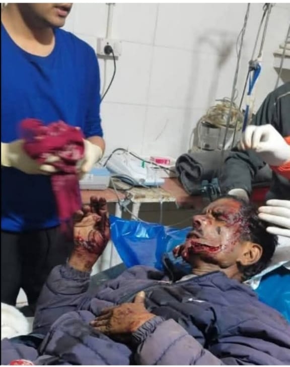 कौन समझेगा पहाड़ की पीड़ा कहीं तेंदुआ  तो कहीं भालू के हमले से लोगों की जा रही जाने